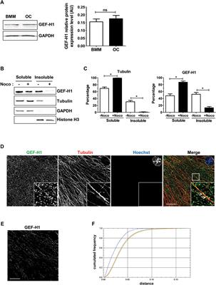 Bone resorption by osteoclasts involves fine tuning of RHOA activity by its microtubule-associated exchange factor GEF-H1